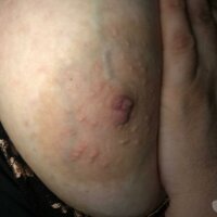 1 Female Escort photo